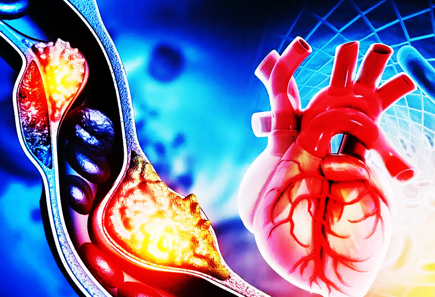 Heart Cupping Therapy Singapore, Recommended Heart Cupping Center in Singapore